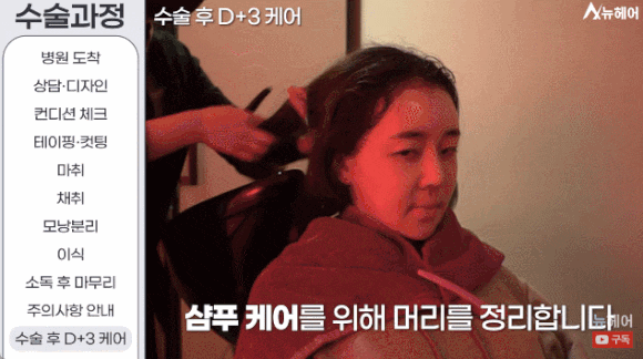 모발이식과정? A~Z 전부 공개합니다(동영상 포함) 관련 이미지 12
