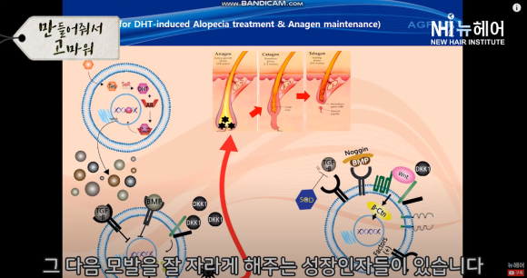 #1 [만들어줘서 고마워] 탈모제품 노하우 전수받으러 찾아 갔습니다 관련 이미지 2