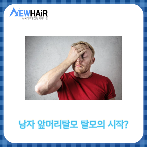 남자 앞머리탈모 정확한 치료방법은? 관련 이미지 2
