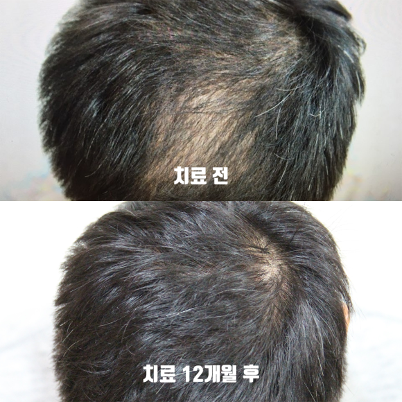 [뉴헤어] 관련 이미지 4