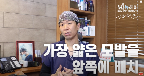 헤어라인교정, 굵은 머리는 힘들까요? ㅣ 여자 모발이식 관련 이미지 6