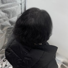 여성두피문신? 60대 실제 사례 사진으로 확인하세요 관련 이미지 8