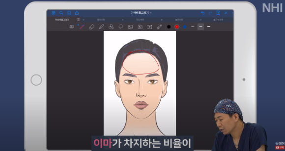 [뉴헤어] 성형외과 의사가 알려주는 이상적인 헤어라인 비율 관련 이미지 2