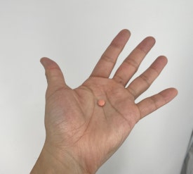Finasteride for Hair Loss: How Can You Take It Safely? image 2