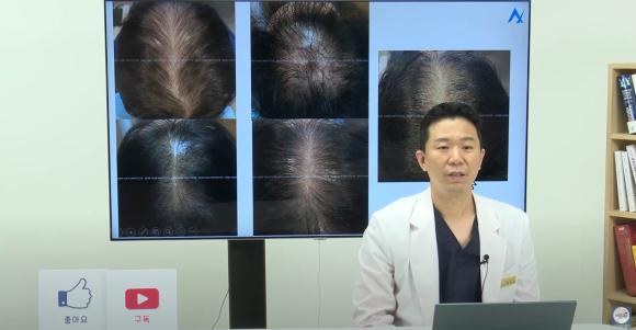 [비온뒤X뉴헤어]여성 탈모치료, 탈모 이렇게 치료해요 관련 이미지 2