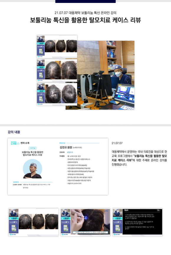 [뉴헤어] 김진오 원장, 보툴리눔 톡신 탈모치료 케이스 리뷰 온라인 강의 관련 이미지 1