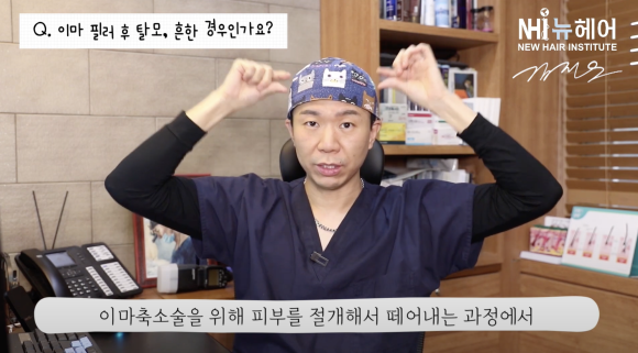 이마 필러 ∙ 이마축소술 후 탈모 생기신 분? 관련 이미지 4