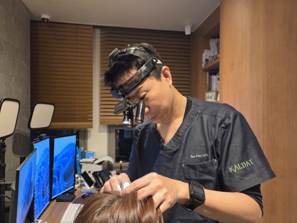 The Connection Between Alopecia Areata and Stroke: What You Should Check If You Have Had Alopecia Areata image 5