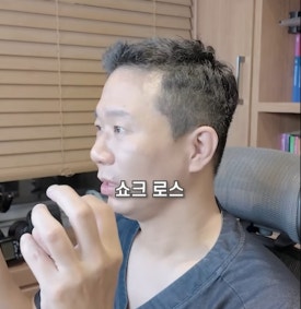 모발이식 후 머리 빠짐, 생착 실패일까? 암흑기·밀도·붉은기 관련 이미지 3