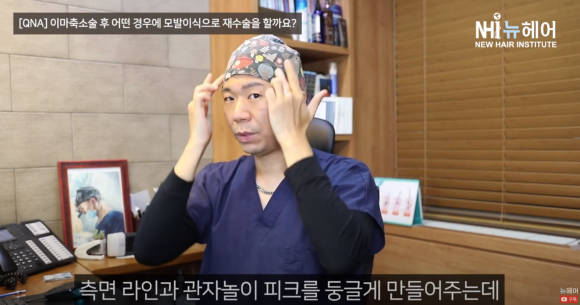 이마축소술했지만 모발이식 재수술하는 경우 ㅣ헤어라인교정 ㅣ 이마축소술 흉터 관련 이미지 7