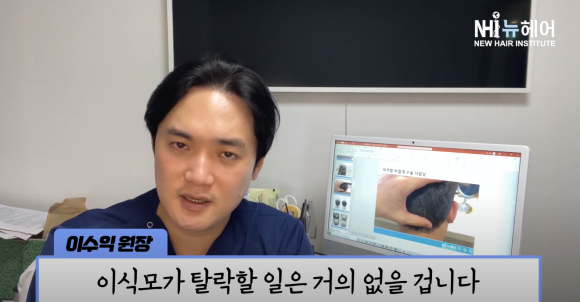 모발이식 실패? 이식모가 빠질 수 있나요? 관련 이미지 21