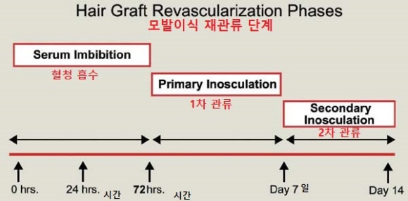 모발이식 받은 사람은 꼭 알아야할 이식모 생착 과정 총정리: 어떻게 하면 더 잘자랄까? 관련 이미지 6