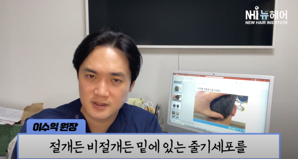 모발이식 실패? 이식모가 빠질 수 있나요? 관련 이미지 19
