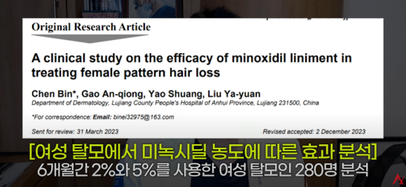 여성탈모는 남성용 미녹시딜을 써라?(효과,부작용) 관련 이미지 4