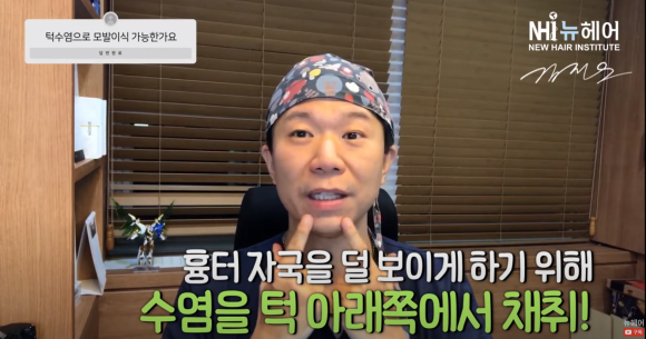 모발이식을 턱수염으로도 할 수 있다? 관련 이미지 2