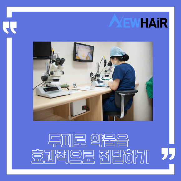 탈모 모낭주사 치료 효과는? 관련 이미지 3