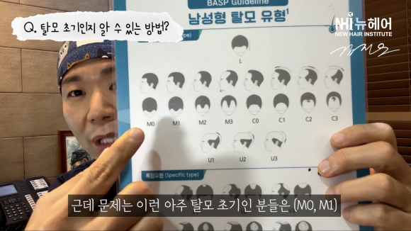 탈모 기준 l 탈모 초기 판단하는 방법 l 자가 진단 관련 이미지 1