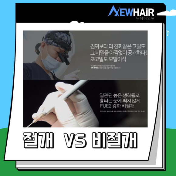 절개 모발이식 수술 총정리 관련 이미지 5