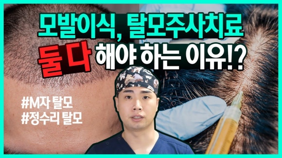M자 모발이식 확인해야 할 것 관련 이미지 25