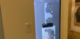 탈모진단, 개인별 두피는 어떻게 파악할까? 관련 이미지 2