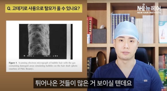 고데기 탈모? 고데기 사용 후 모발 손상... 머리숱 줄어든 느낌이라면 관련 이미지 6