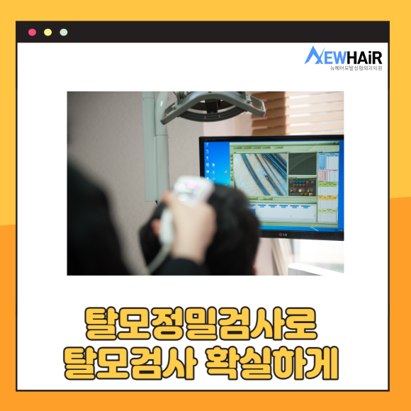 탈모정밀검사로 탈모검사 확실하게 관련 이미지 1