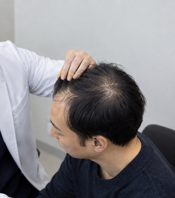 앞머리와 정수리가 같이 비었다면 어디부터 모발이식해야 할까? 관련 이미지 3