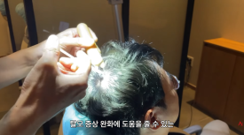 What Are the Effects and Side Effects of Follicular Injections? image 3
