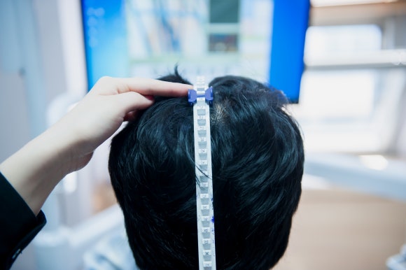 엠자탈모 확실한 치료법은? 관련 이미지 10