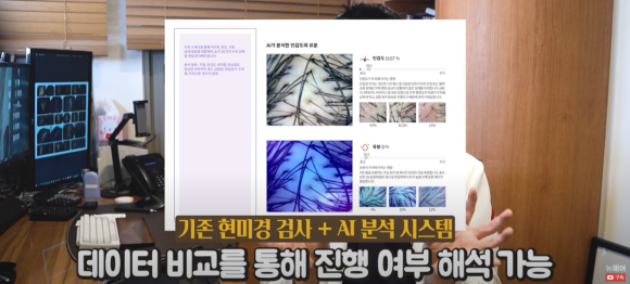 탈모검사? 저희의 AI / 3D 검사를 소개합니다 관련 이미지 4