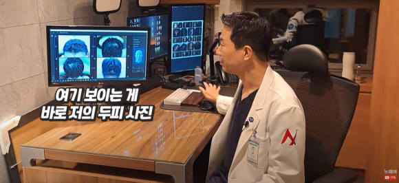 탈모검사? 저희의 AI / 3D 검사를 소개합니다 관련 이미지 8