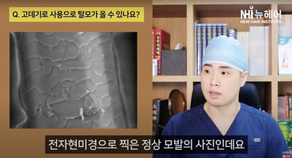 고데기 탈모? 고데기 사용 후 모발 손상... 머리숱 줄어든 느낌이라면 관련 이미지 4