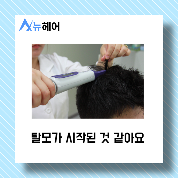 탈모치료 비수술로 가능하다? 관련 이미지 2