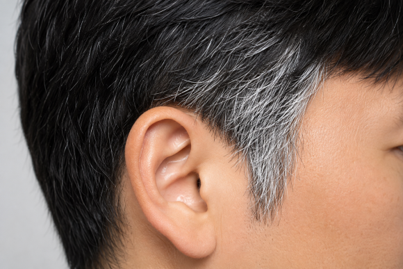 Why Do Gray Hairs Appear Only on the Sideburns? What Causes Gray Hair to Cluster There? image 1