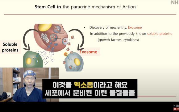 탈모치료 엑소좀, 엑소좀 뜻, 역할, 탈모 치료 효과ㅣ 정수리 탈모 ㅣ 전후사진 관련 이미지 6