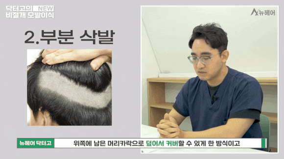 비절개모발이식 종류와 선택 가이드 관련 이미지 3