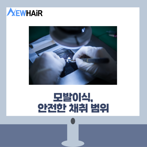 서울탈모 이식 병원 만족하는 결과를 위해 관련 이미지 3