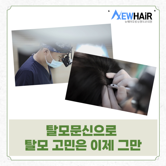 탈모문신으로 탈모 고민은 이제 그만 관련 이미지 1