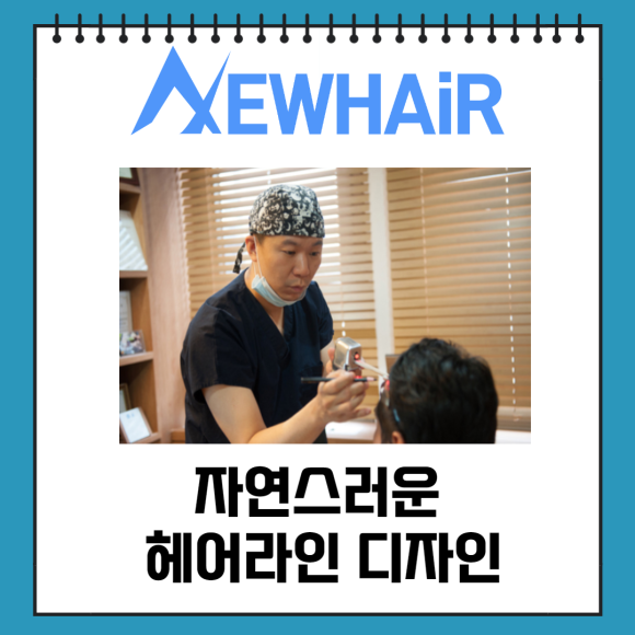 여성 헤어라인 모발이식 고민이라면 관련 이미지 3