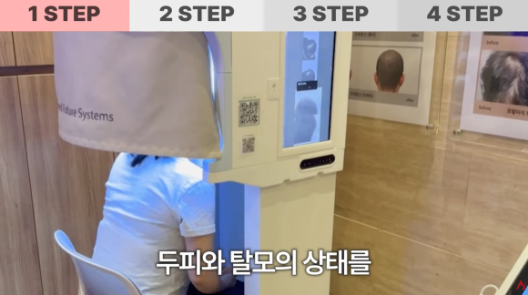 머리카락 많이 빠지면 탈모일까? 정상 기준은? 관련 이미지 3