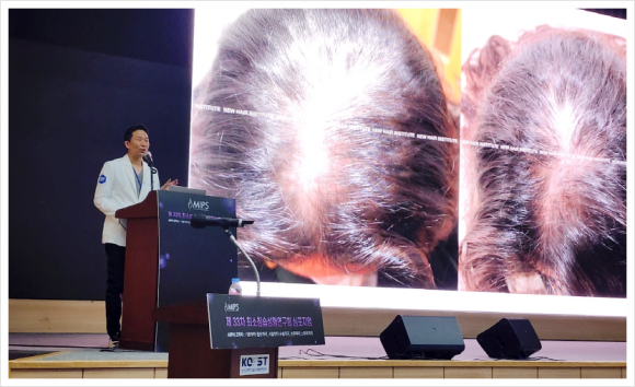 탈모병원추천? 17년차 전문의가 알려드립니다 관련 이미지 3