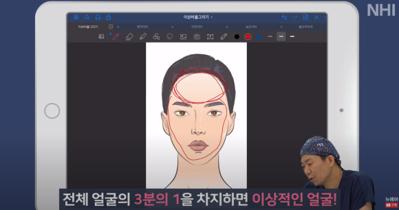 [뉴헤어] 성형외과 의사가 알려주는 이상적인 헤어라인 비율 관련 이미지 3