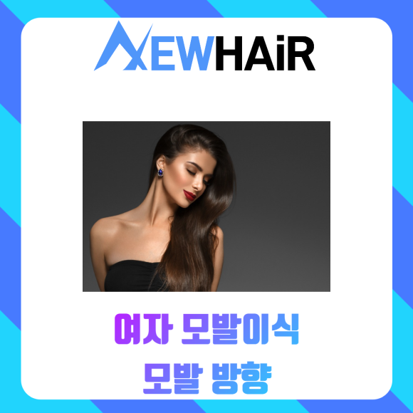 여자 모발이식 자연스럽게 관련 이미지 5