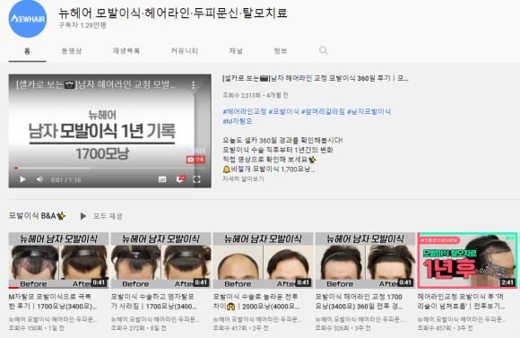 강남역 모발이식 상담 필수 질문은? 관련 이미지 6