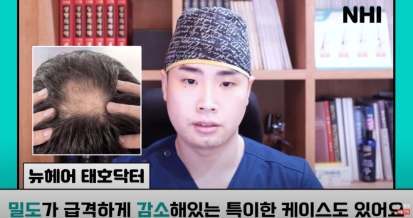 [뉴헤어] 모발이식으로도 해결 안 되는 탈모가 있다? l 탈모 주사의 효과는? 관련 이미지 12