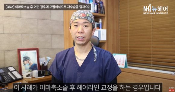 이마축소술했지만 모발이식 재수술하는 경우 ㅣ헤어라인교정 ㅣ 이마축소술 흉터 관련 이미지 8