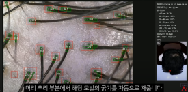 What Can Hair Loss Testing Tell Me About My Hair Loss Treatment? image 4