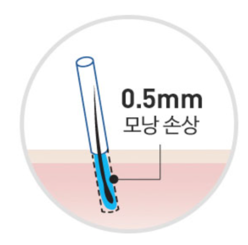 무삭발비절개? 하지 마세요 관련 이미지 2