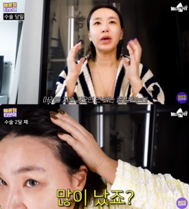 안무가 배윤정 씨, 출산 후 모발이식으로 찾는 자신감 관련 이미지 3
