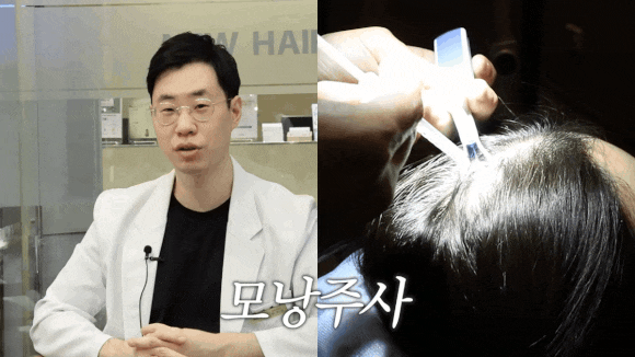 탈모 치료, 지금 시작해야 하는 이유 관련 이미지 6